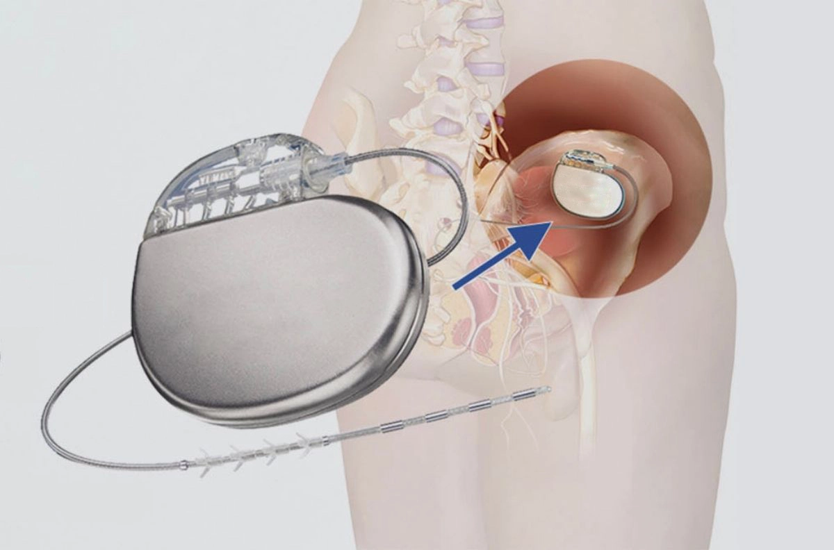 Advanced Bladder Treatment with Prof. Dr. Emre Huri